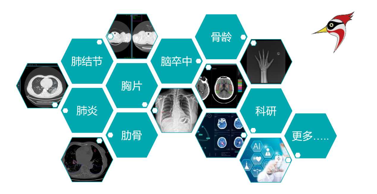 AI影像辅助云诊断解决方案